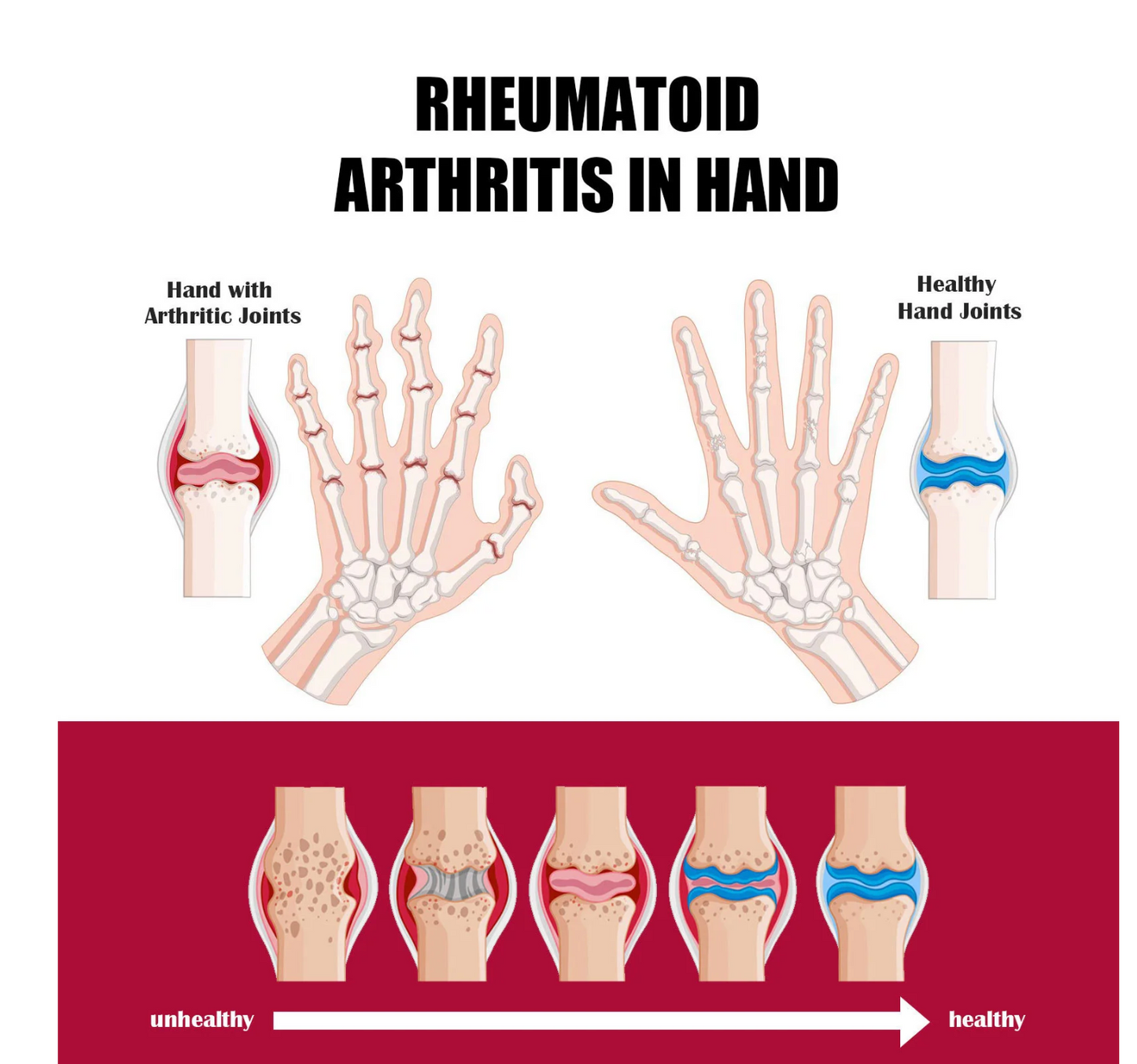 Bee Venom Joint and Bone Therapy Advanced Cream