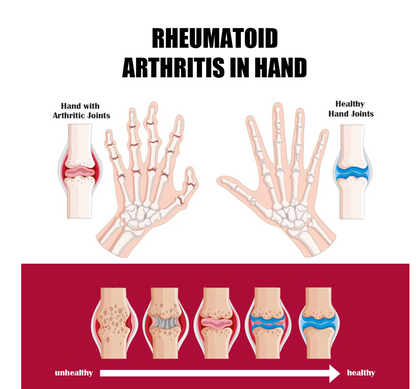 Bee Venom Joint and Bone Therapy Advanced Cream